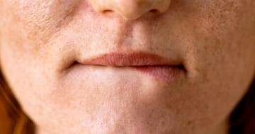 I Thought My Lip Biting Habit Was Harmless — Then An Expert Set Me Straight