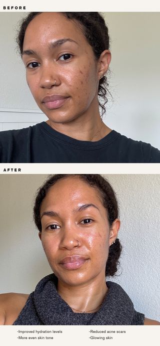 Beauty editor before and after using Eighth Day's Regenerative Serum.