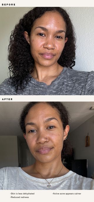 A beauty editor before and after trying Tower 28's Cleanser